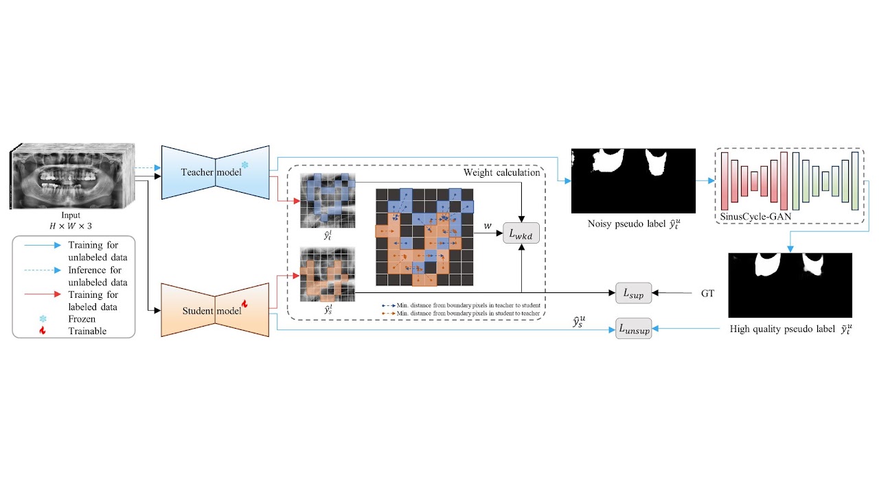 Weighted knowledge distillation architecture for maxillary sinus segmentation