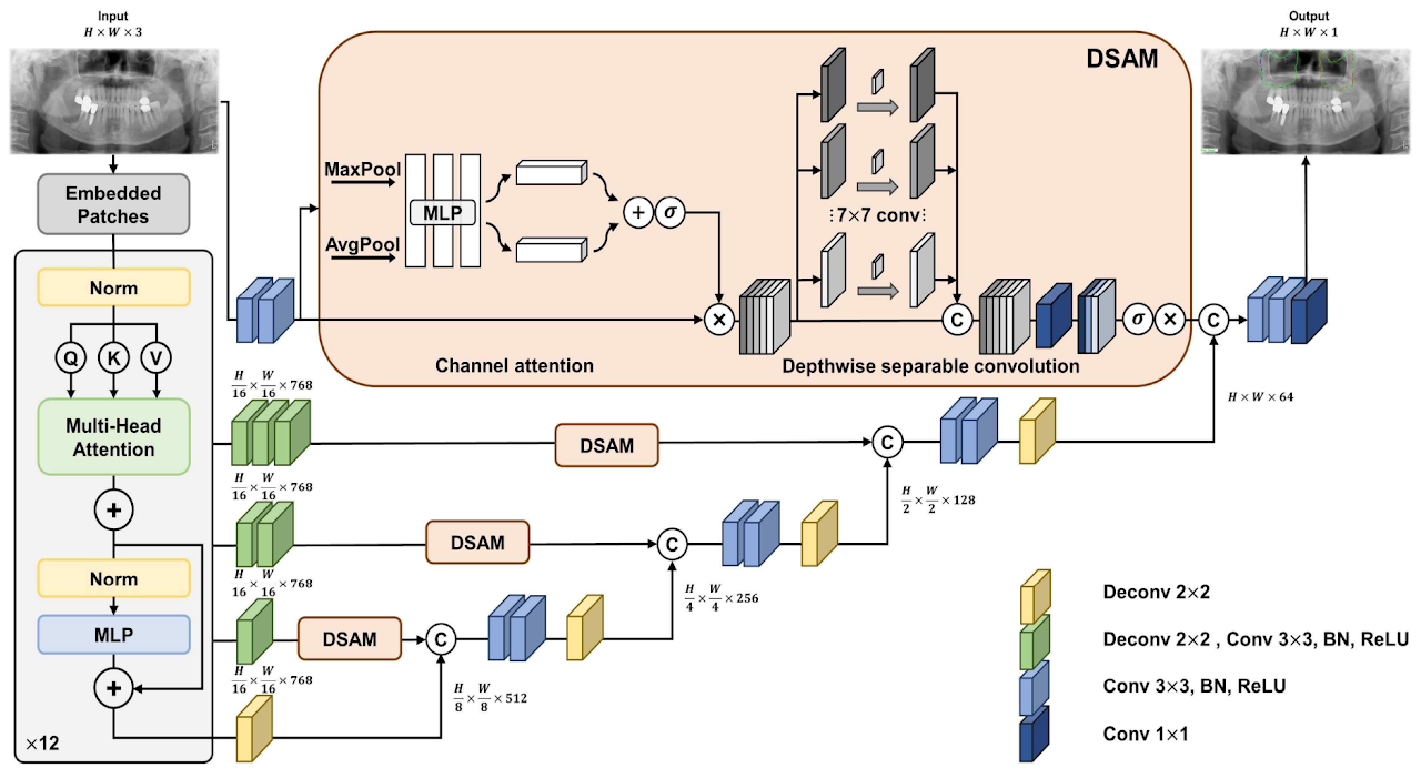 Attention-based U-Net transformer for panoramic X-ray segmentation